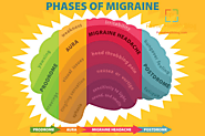 The Ultimate Revelation Of Migraine Symptoms » Prime Health Blog