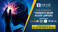 Website at https://justinforjustice.com/practice-area-brain-injury-lawyers/