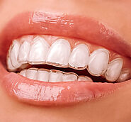 Invisalign clinic |Teeth straightening - Galaxy Dental