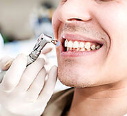 Dental Hygiene Canada | Dental Hygiene Calgary - Galaxy Dental