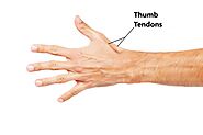 Quervain's tenosynovitis | Dequervainscure