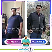 تاثیرات عمل چاقی بر روی عملکرد بدن چقدر است؟ - کلینیک فوق تخصصی لاغری