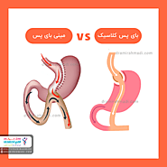 اصلی‌ترین تفاوت‌ها بین جراحی لاغری بای پس معده و مینی بای پس - کلینیک فوق تخصصی لاغری