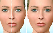 What is Corrective Jaw Surgery or Orthognathic Surgery?
