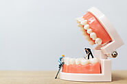 Dental Implants Melbourne | Teeth Implants Melbourne