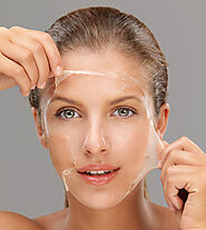 Chemical Peels Unveiled: Transforming Skin, One Layer at a Time -