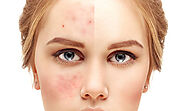 Reveal Radiant Skin with Advanced Skin Treatment at Image Clinic