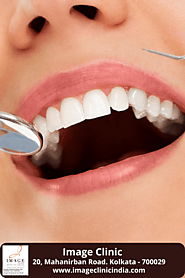 Find Best Dental Treatments in Kolkata - Image Clinic