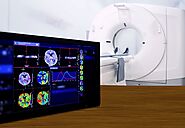 How Teleradiology Can Help Early Management of Acute Stroke - Cloudex Radiology