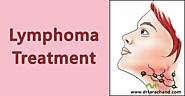 Lymphoma Cancer Treatment in Jaipur by Dr.TaraChand | Oncologist