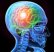 How a brain injury occurs? | Singleton Law Firm LLC.