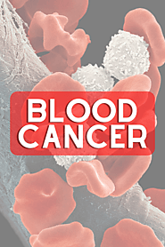 Looking for the Best Blood Cancer Doctor in Delhi NCR?