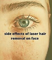 Website at https://usalaserhair.com/side-effects-of-laser-hair-removal-on-face/