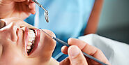 Comprehensive Dental Care - Dental Cavities, Crowns and Bridges