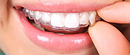 A Complete Guide to Invisalign Treatment at Trillium