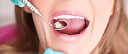 How Dental Cavities are Treated