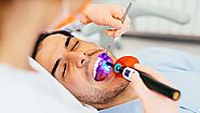 A Complete Guide to Tooth Decay