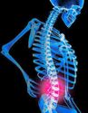Mechanical Disorders of The Musculoskeletal Back Pain Prevention & Treatment | New Age Physical Therapy