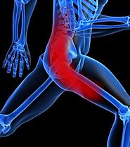 Sciatica Physical Therapy | New Age Physical Therapy
