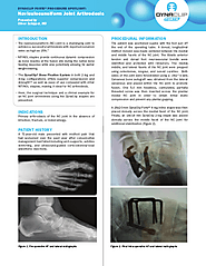 DynaClip Forte® Procedure Spotlight - Naviculocuneiform Joint Arthrodesis | Oliver Schipper, MD