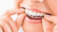 Havens Orthodontics: The Pros and Cons of Invisalign Treatment