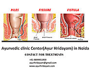 See How Effectively You Can Get Piles treatment in Noida – ayur hridayam