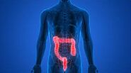 Know more about intestine health treatment in Miami