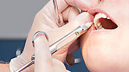 Dental Anaesthesia in Singapore