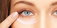 Best Cost Eyelid Surgery in Delhi - NCR