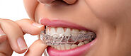 Invisalign Dentist in Dubai - Cross Dental