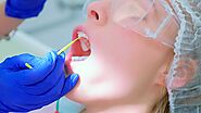 Fluoride Treatment for Healthy Teeth in King of Prussia, PA