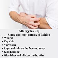 The best treatment for itching Treatment of skin allergies (Allergy Ka Ilaj).