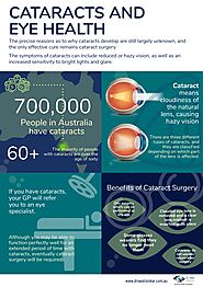 Cataract Surgery in Australia