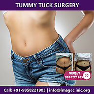 Dr Kashyap Performs the Tummy Tuck Surgery in Delhi
