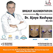 Best Breast Augmentation in Delhi, Implant Surgery Cost in Delhi