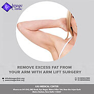 Best Arm Lift Surgery by US Board Certified Surgeon Dr. Kashyap in Delhi