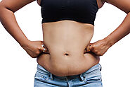 Tummy Tuck Surgery with Stretch Marks Removal Cost in Gurgaon, Delhi