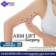 Best Arm Lift or Brachioplasty Surgery by Dr Kashyap in Delhi