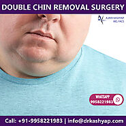 Double Chin Procedure in Delhi, Double Chin Fat Removal Cost in Delhi