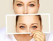 Eyelid Surgery in India - Best Blepharoplasty Clinic in Delhi