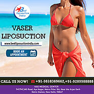 Fat Removal of Tummy by Vaser Liposuction Surgery | Dr Kashyap, Delhi, India