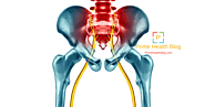 Understand The Background Of sciatica with its symptoms-causes. » Prime Health Blog