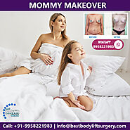 Mommy Makeover Surgery Gives you the Desired Pre-Pregnancy Body Back