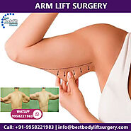 Dr. Ajaya Kashyap: Arm Lift Surgery Clinic in Delhi India