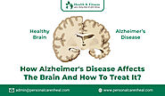 How Alzheimer's Disease Affects the Brain and How to Treat It?