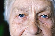 What Seniors Need to Know About Glaucoma