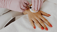 Hand Rejuvenation Toronto - Therapeutic Aesthetics