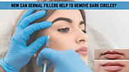 Dermal Fillers Help to Remove Dark Circles | The Recipe Villa