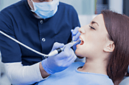 The Best Cosmetic Dentist In San Diego To Your Rescue