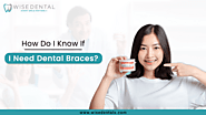When You Need Dental braces?